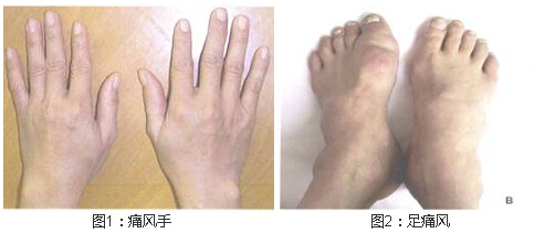 F(yng)(qing)ֱt(y)ԺʹL(fng).jpg